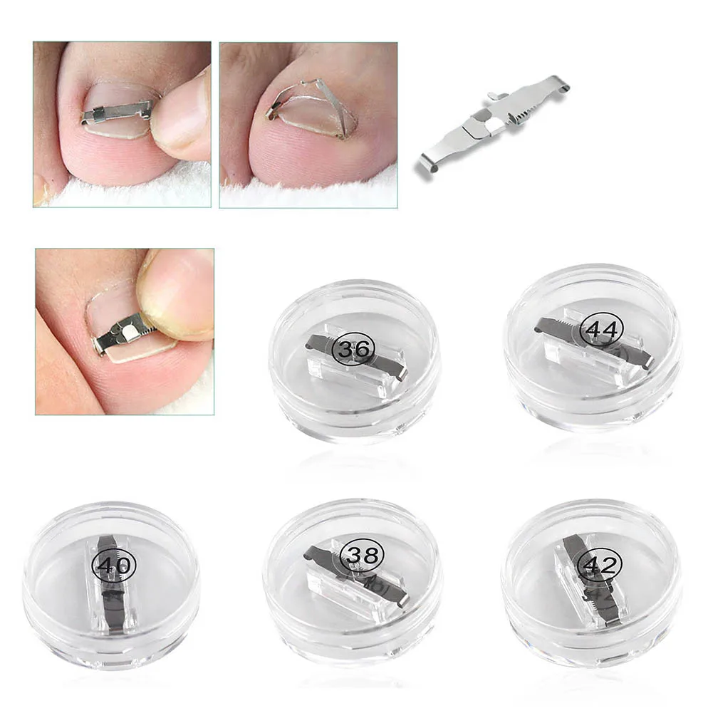 

Stainless Steel Ingrown Toe Nail Corrector Pedicure Treatment Embed Tool Orthotics Protector Bones Overlapping Pedicure