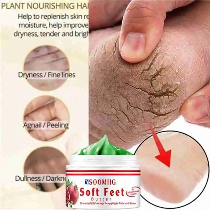 

15g/30g/50g Oil Foot Cream Dead Skin Remover Anti-Drying Cream Heel Skin Care Product Treament Care Cracked Repair Feet V1B8
