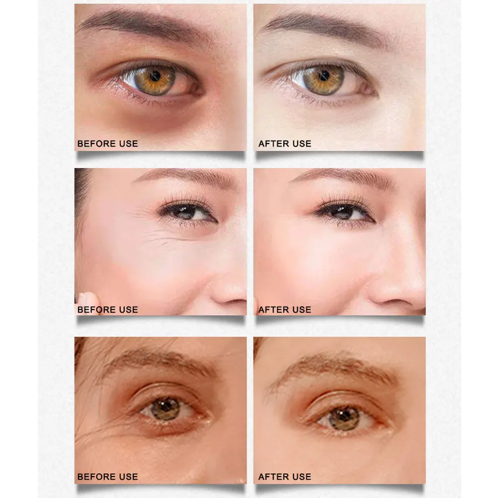 ARTISCARE Gold Osmanthus Eye Patches 2PCS Remove Dark Circles Hyaluronic Acid Moisturizing Masks Anti-Puffiness Care | Красота и