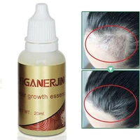 20ml 100 natural ginger hair growth essential oil liquid hair loss oil liquid hair loss products leave in hair scalp treatment