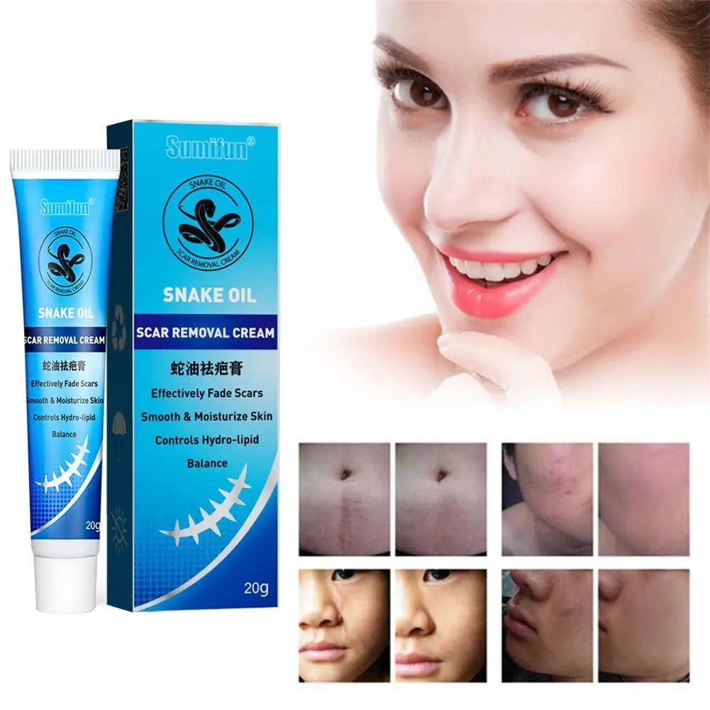 

20g Old Scars Eraser Cream Healing Remove Pregnancy Cream Burns Cuts Ointment Powerful Stretch Marks Skin Repair Removal