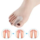 1 пара Силикагель-узор, исправляющий искривление большого пальца на каждый день Применение разделитель для пальцев ноги коррекция носка ноги реабилитации, забота о ногах, инструмент