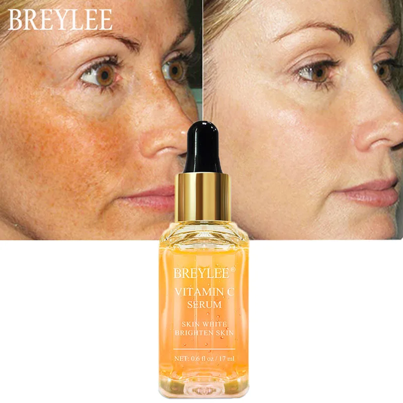 

BREYLEE Vitamin C Face Serum Whitening Freckle Essence Fade Dark Spot Brighten Anti-oxidant Remove Melanin Improve Skin Dullness