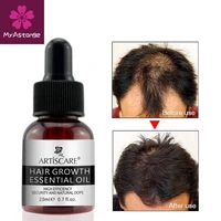 hair care hair growth essential oils for hair loss repair and treatment essence dense artiscare hair regrowth serum