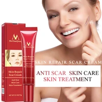 acne scar removal face cream acne spots acne pigmentation corrector whitening cream anti scar stretch marks repair gel skin care