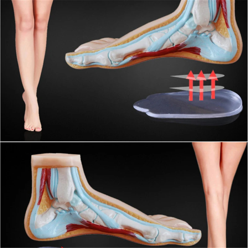 1Pair Orthopedic Insoles Shoe Inserts Medial &amp Lateral Heel Wedge Lift GEL Pads Corrective O/X Type Leg For Women/Men Studant | Красота и