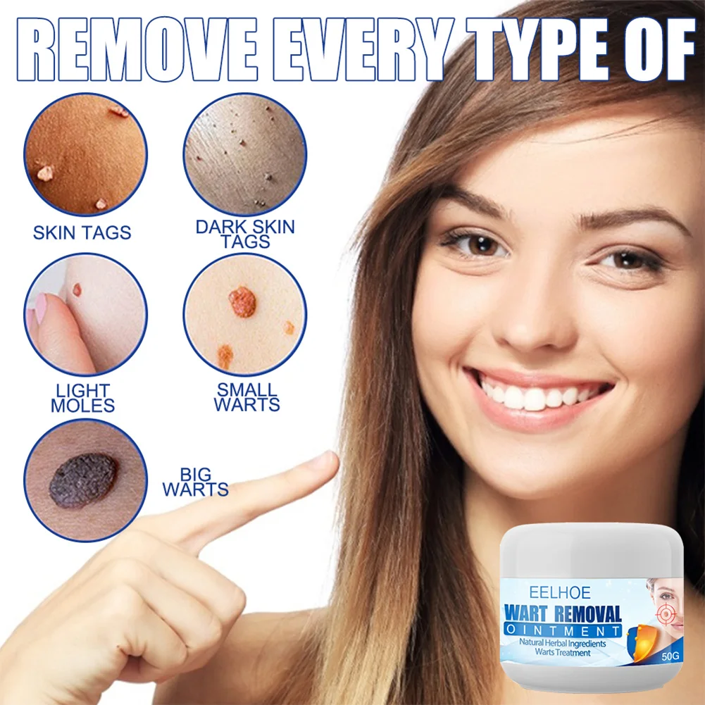 

Wart Remover Safe Painless Skin Tags Removal Ointment Fast Acting Remover Cream for Warts Moles Corn for All Skins New Hot
