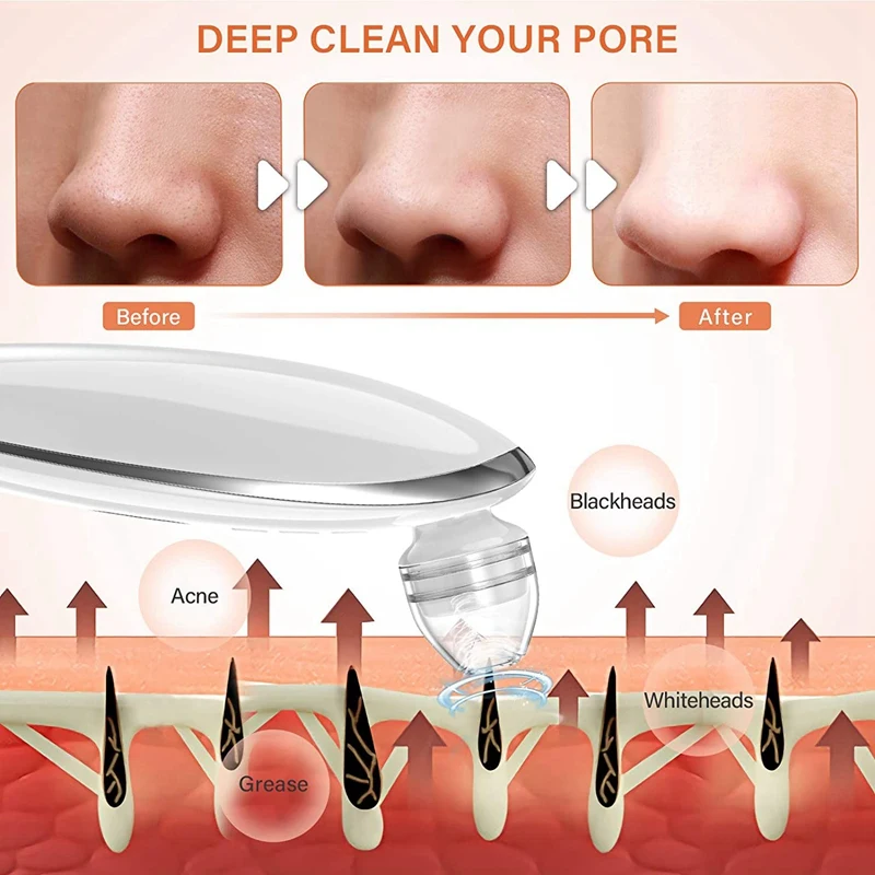 

WiFi Blackhead Remover Wireless Camera USB Rechargeable Facial Pore Cleaner Acne Pimple Black Head Clean Skin Tool