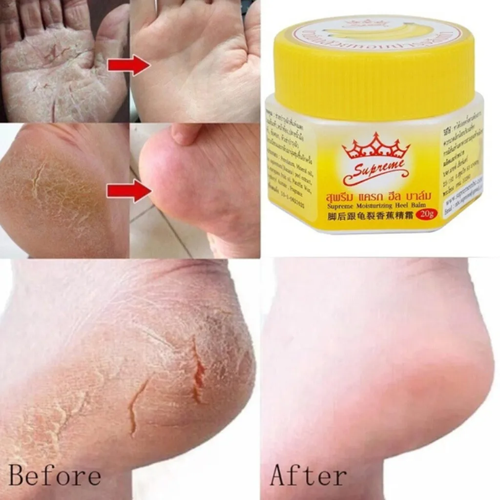 2019 Уход за ногами педикюр анти сушильный крем от трещин отмершей кожи удаления