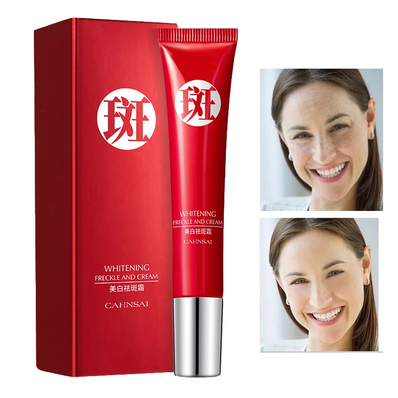 

20gEffective Whitening Freckle Cream Remove Melasma Acne Spot Pigment Melanin Dark Spots Pigmentation Moisturizing Gel Skin Care