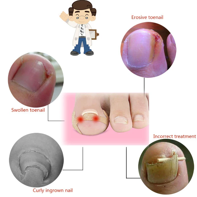 

20pcs New Design Ingrown Toenails Band Aid Relief Pain Paronychia Correction Sticker Repair Bandage for Toe Nail Care