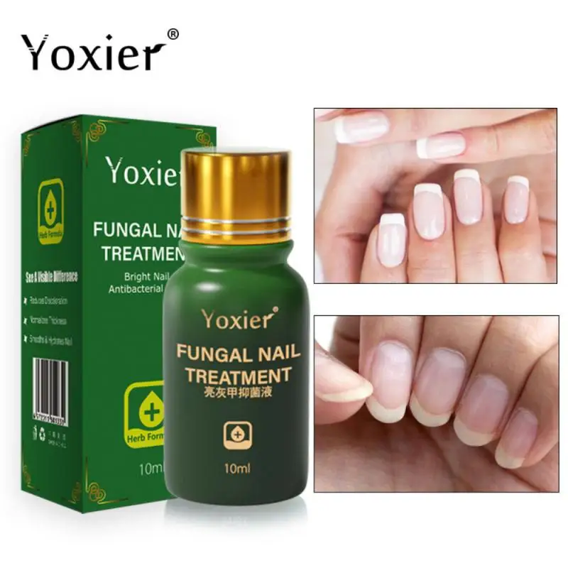 Осветляющий гель для ногтей улучшает утолщение и атрофию|Средства ухода за