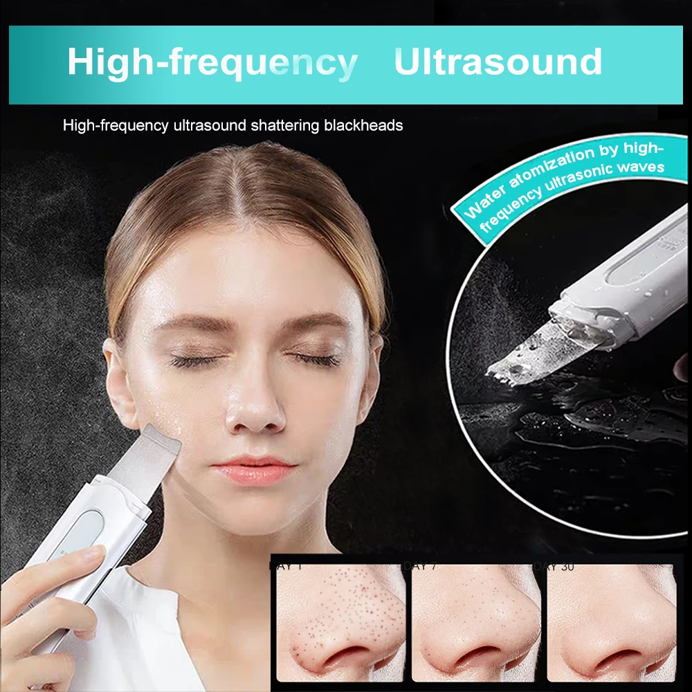 Ультразвуковой скребок для удаления черных точек на коже инструмент лице -