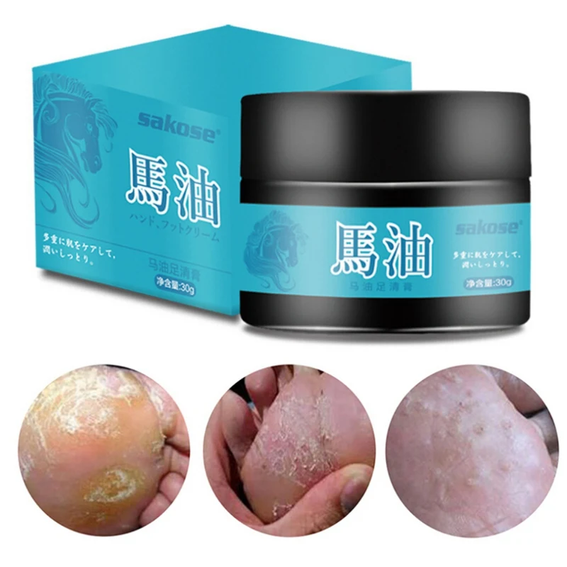 Крем для ног с конским маслом удаления омертвевшей кожи спортсмен средство ухода