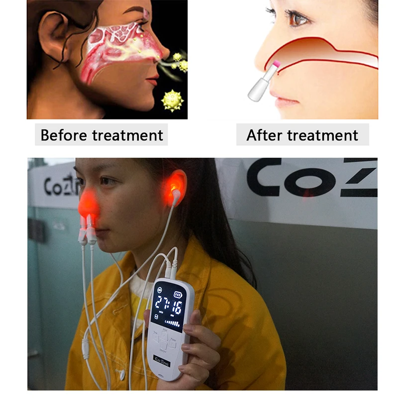 

Dr. Recommend Meniere'S Disease Treatments That Work Laser Physical Therapy Devices For Home /Clinical Usage