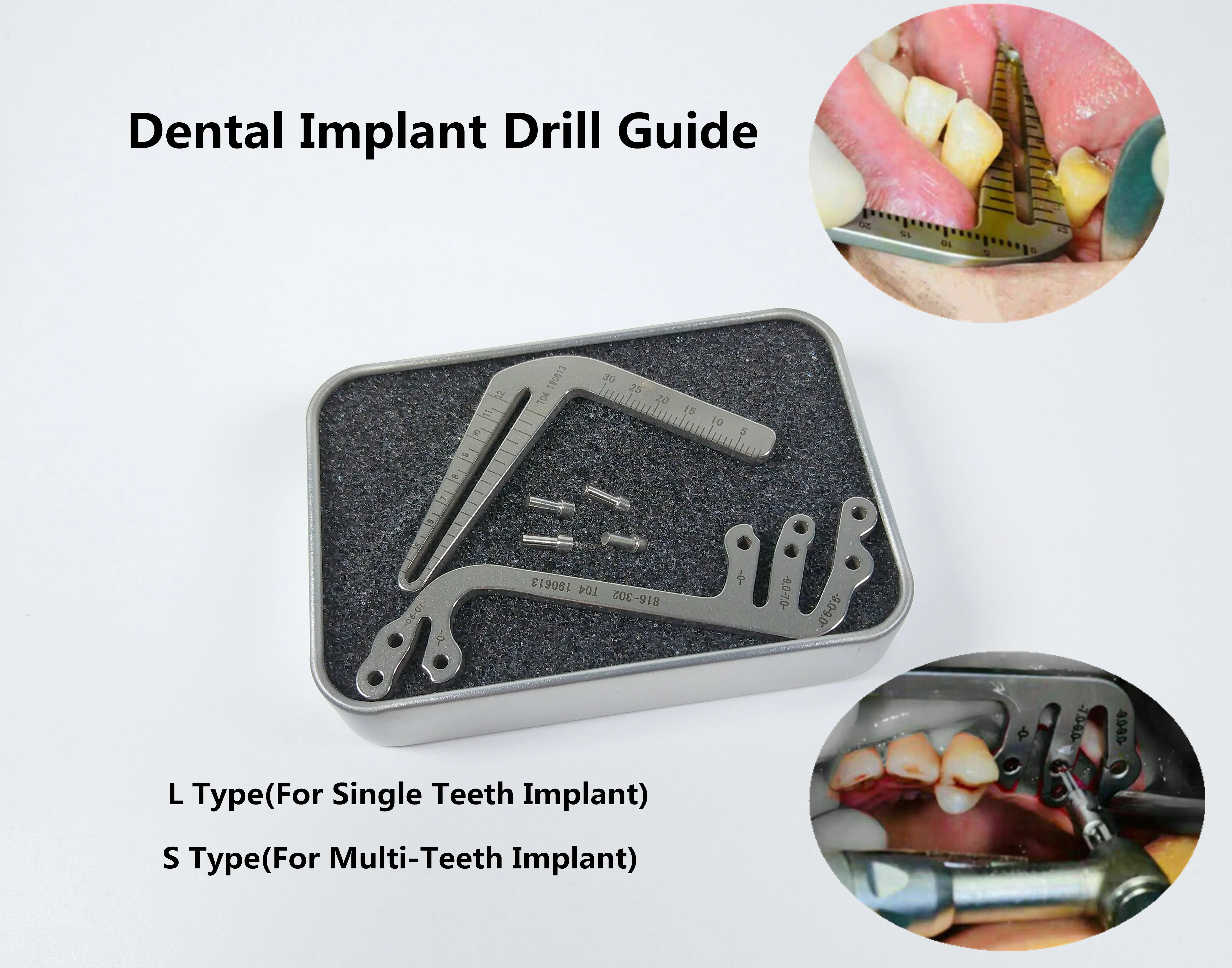 

Set of 6 Dental Drill Locating Gauge Implant Surgical Drilling Guide Planting Position Locator Ruler Parallel Depth Pin Applance