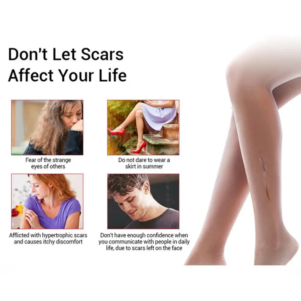 

20g Scar Removal Cream Acne Scars Gel Stretch Marks Pigmentation Surgical Spots Acne Scar Burn Repair Corrector For Body D9U7