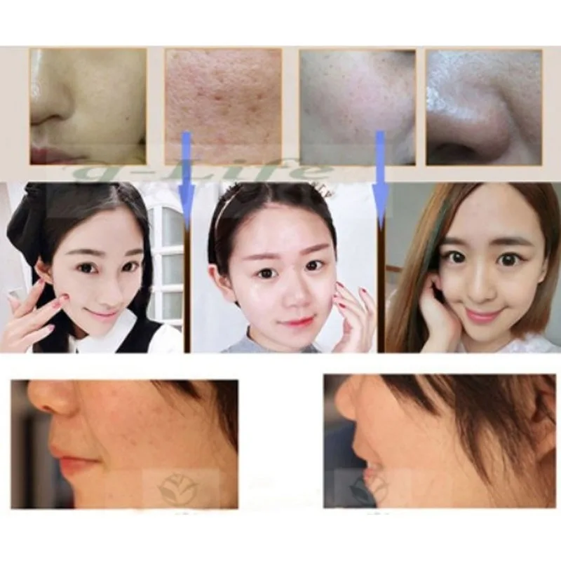 

Contouring Makeup Face Care Beauty Korean Cosmetics BB CC DD Cream Concealer Palette Moisturizing Whitening Brighten