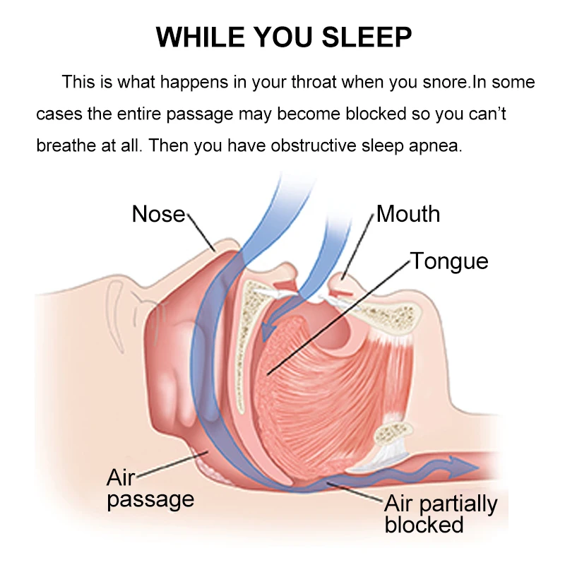 1 шт. антихрап апноэ устройство для сна Анти Храп силиконовый зажим носа