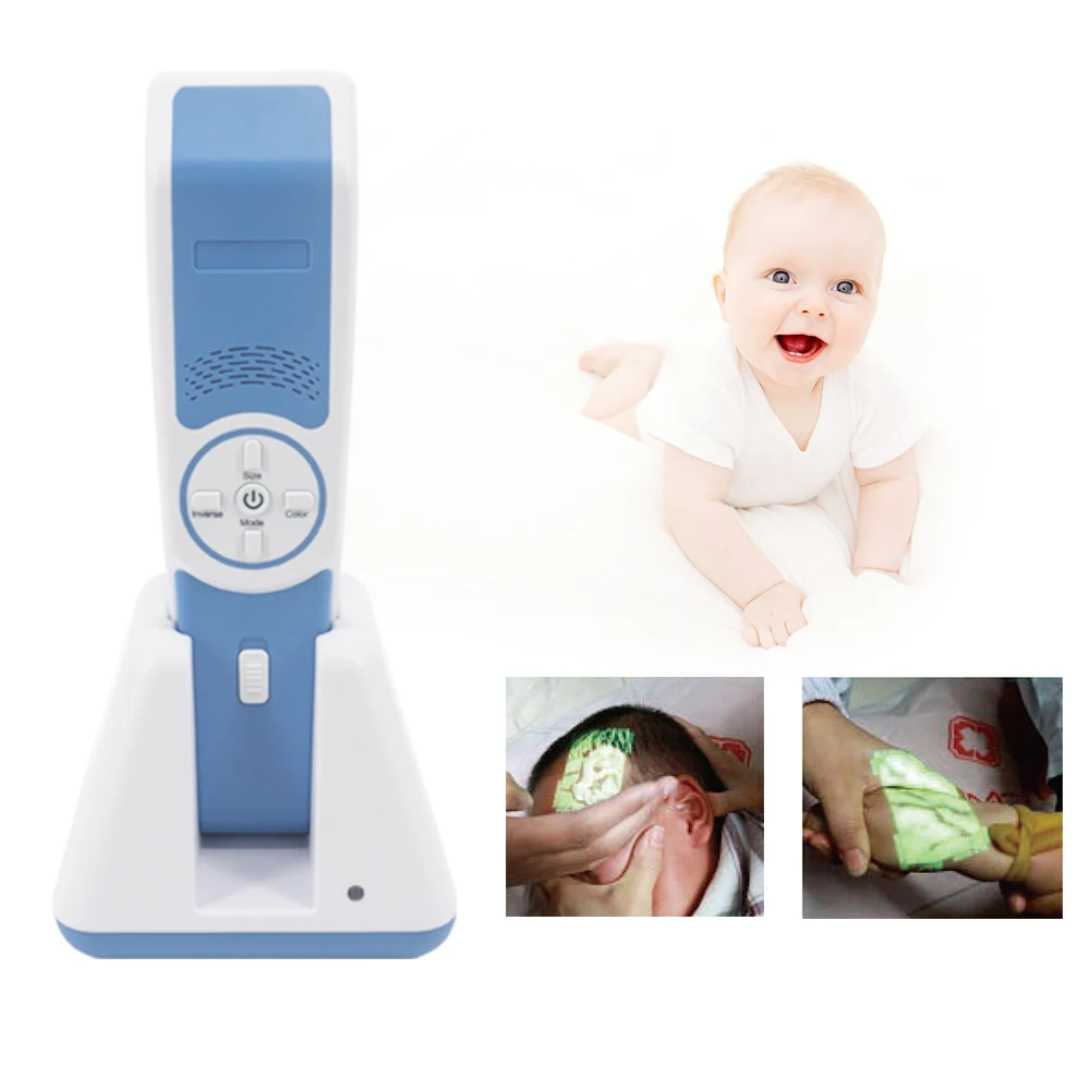 

Medical Vein Viewer System Vein Illuminator Price Portable Vein Finder