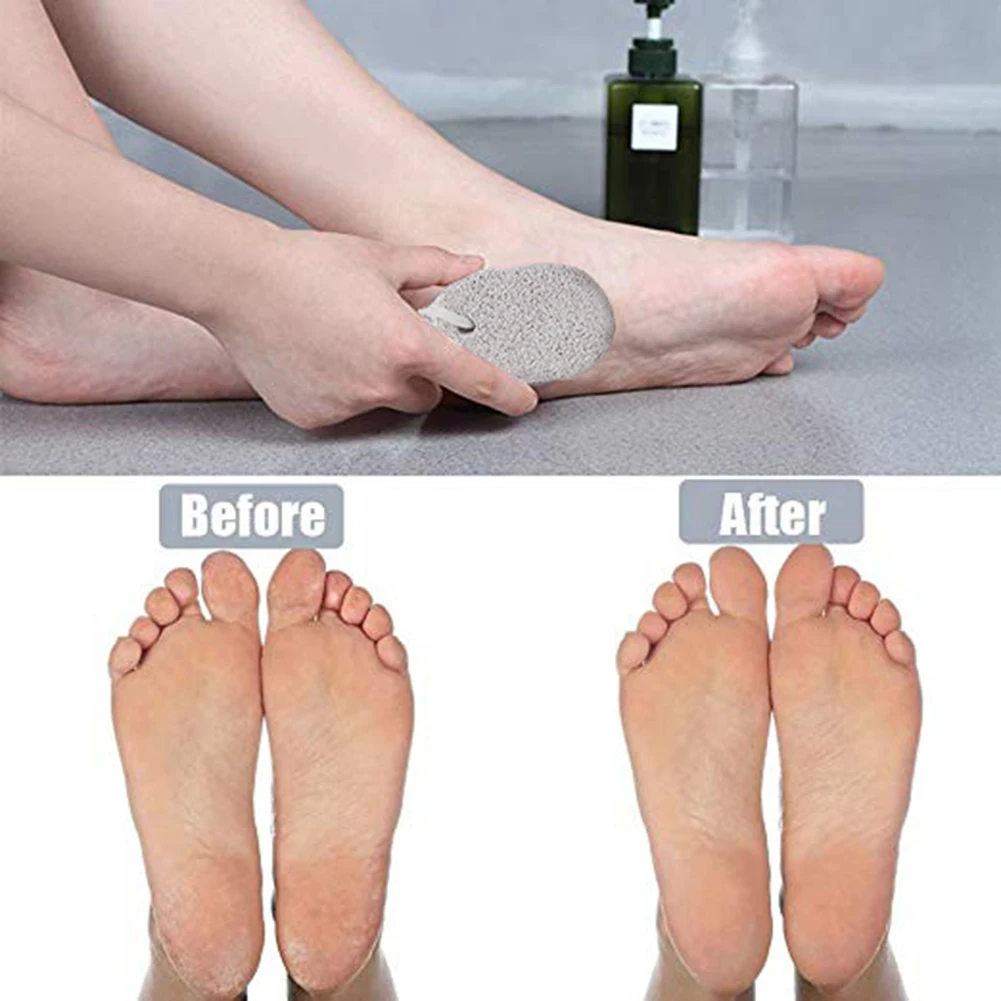 Новая овальная пемза для ног Рашпиль удаления огрубевшей кожи и мозолей пятки