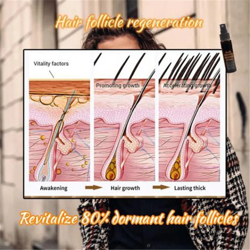 

Hot Hair Regrowth Spray Hair Fast Growth Spray Rapidly Increases Hair Repair Hair t6