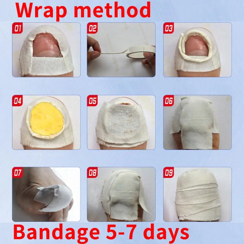 

Chinese Medicine Herbs Toe Nail Fungus Treatment Anti Nail Care Fungal Nail Removal Nail Treatment Essence Lotion Infection G1Z0