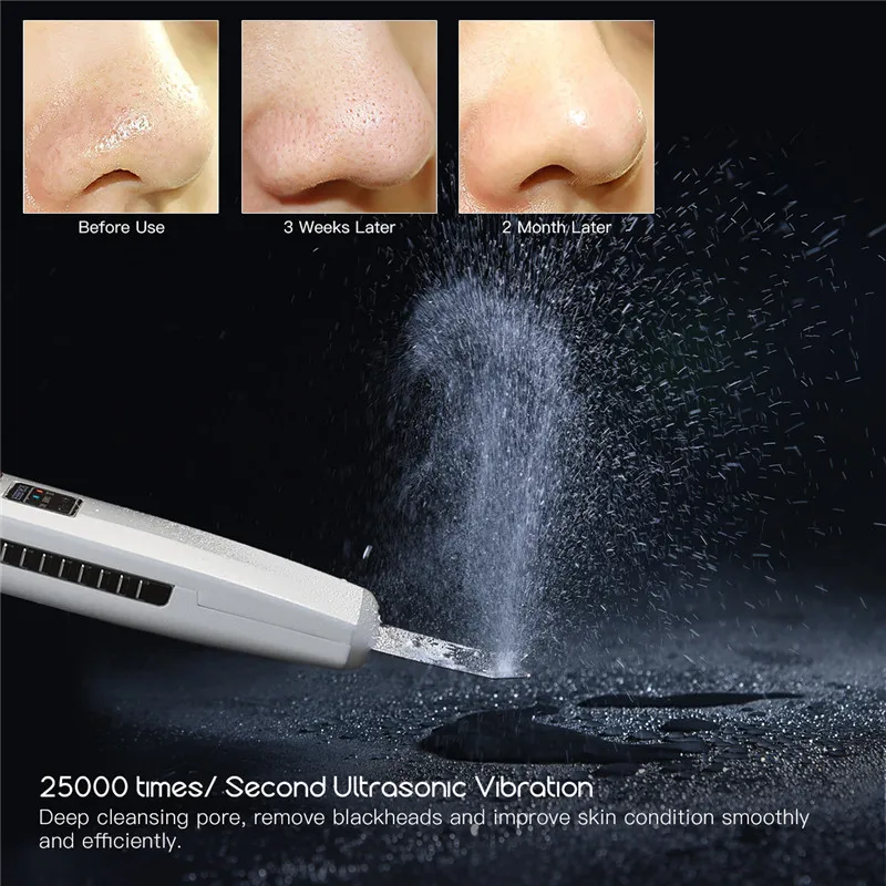 

Ultrasonic ion scraper beauty salon pore cleaner to remove blackhead horny acne