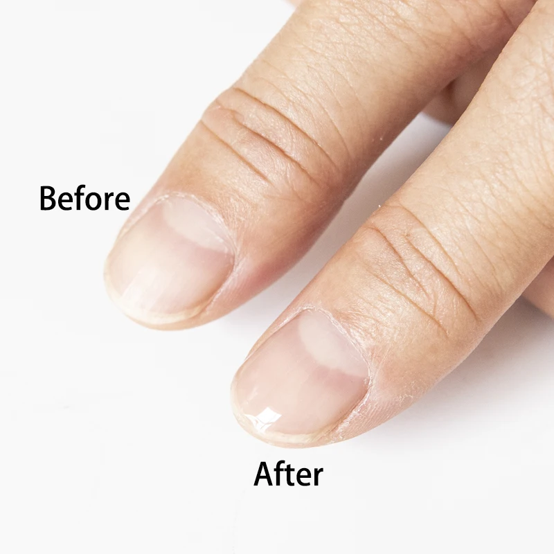Базовое Масло для кутикулы ногтей 2 шт./лот топовое покрытие восстанавливающее