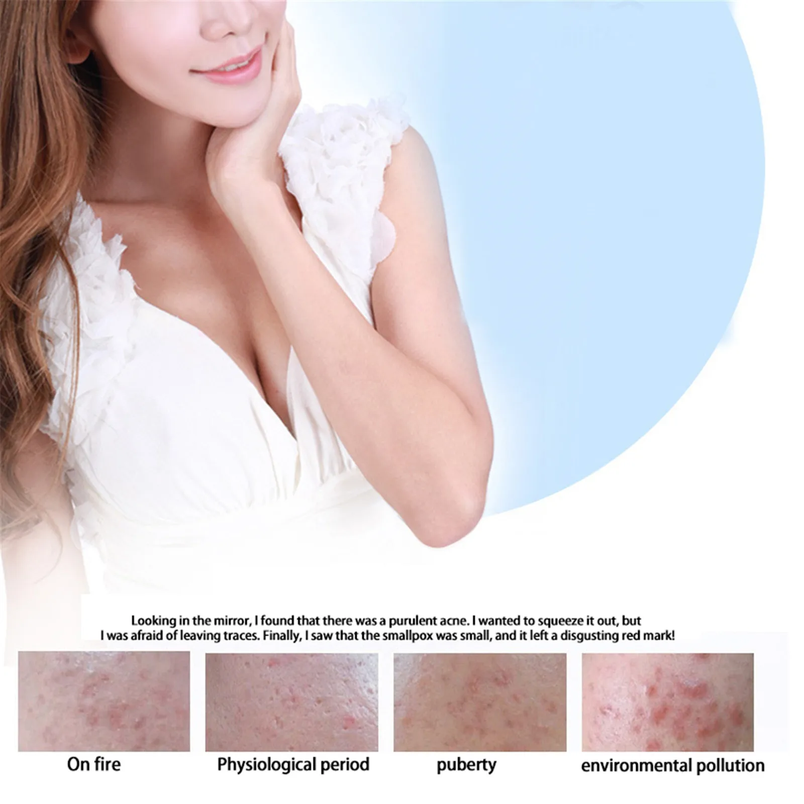 

BIOAQUA Pure Skin Acne Cream Scar Stretch Mark Removal Gel Face Clears Up Blemishes Without Irritating Skin Net content 30g