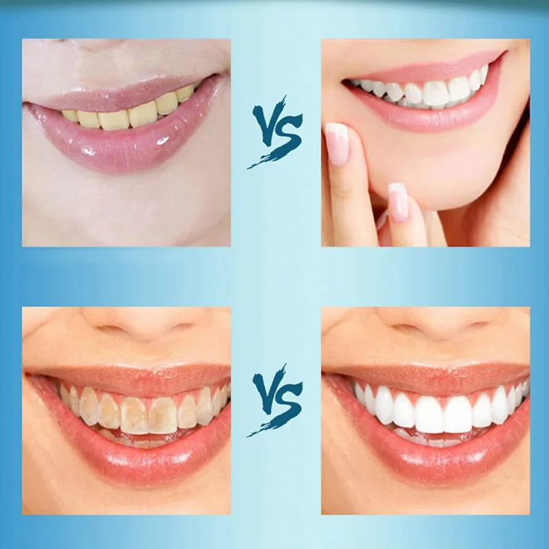 Прямая поставка порошок для отбеливания зубов Perfect Smile Tooth активированный кокос