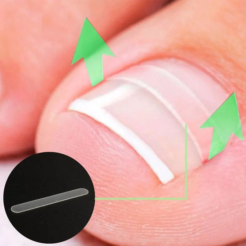 10 шт./компл. BYEPAIN ToeNail Art коррекция вросших наклеек фиксатор Paronychia