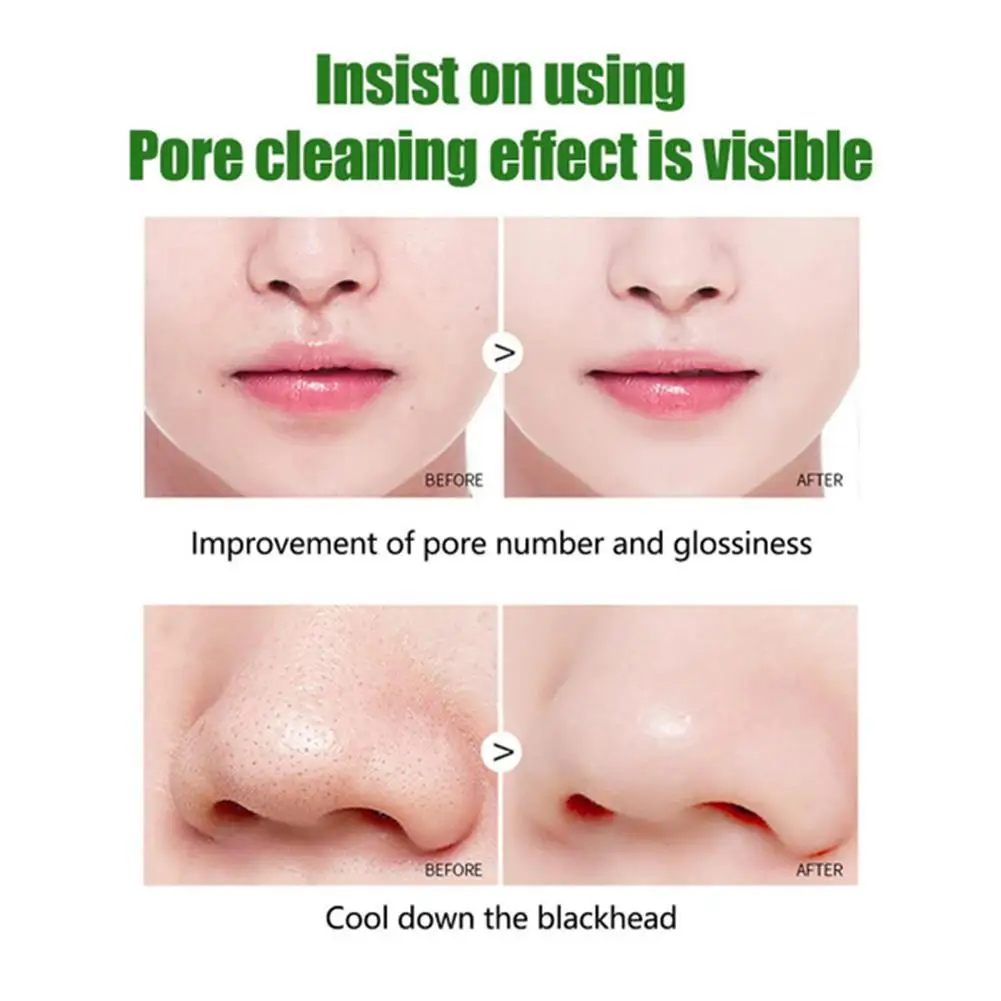 

Green Tea Oil Control Eggplant Acne Cleansing Mask Pores Care Face Remove Blackhead Stick Fine Skin Mask T Care Mud Moistur Q2W9