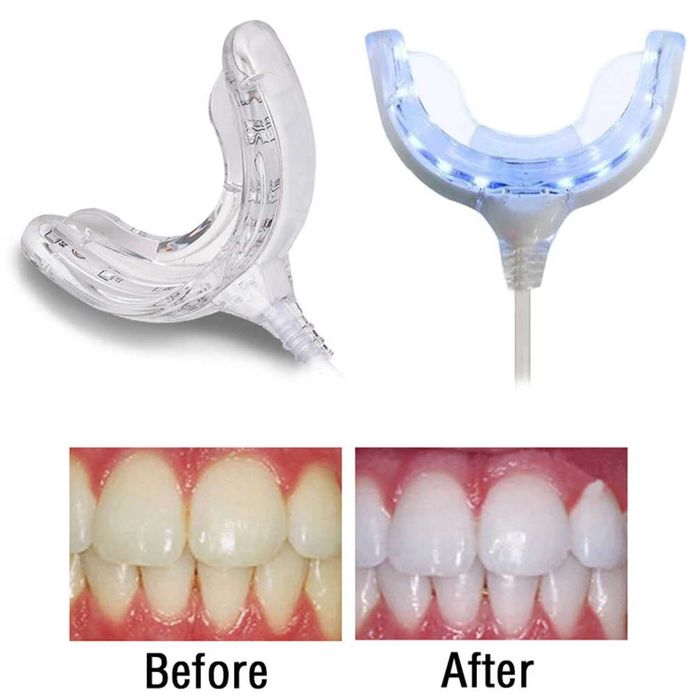 

Smart Led Teeth Whitening Portable Usb Charging Led Blue Light Dental Whitening Instrument Teeth Whitening Device Equipment