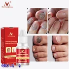 Эссенция MeiYanQiong для восстановления ногтей, масло против грибковой инфекции ногтей, уход за рукаминогами, способствует уходу за ногтями, 10 мл, против инфекции, паронихия