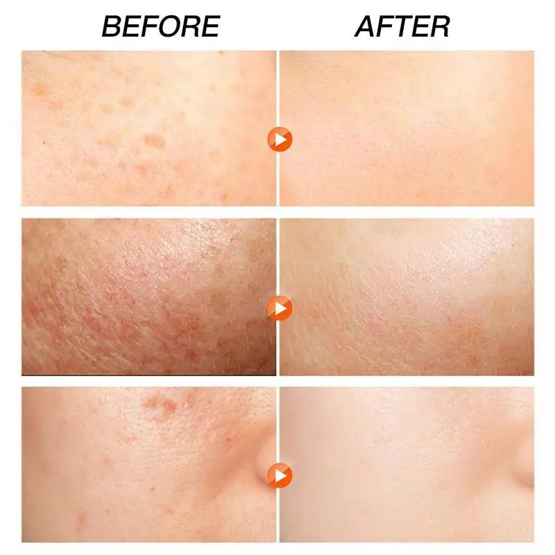 

Skin Care