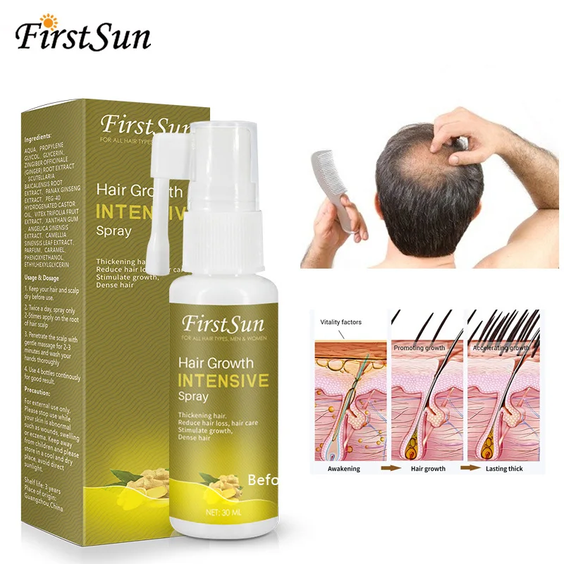 

30ml Hair Growth Intensive Spray Ginseng Ginger Extract Stimulate Hair Growth Oil Dense Thickening Hair Anti Hair Loss Essence