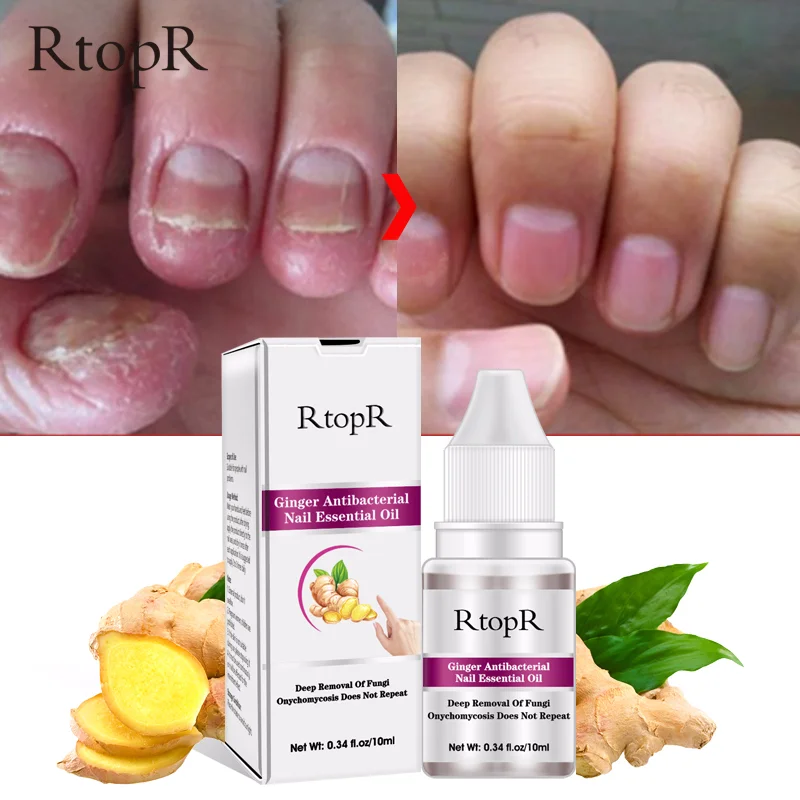 

Nail Repair Essence Serum Fungal Nail Treatment Remove Onychomycosis Toe Nail Nourishing Brightening Hand And Foot Care TSLM1