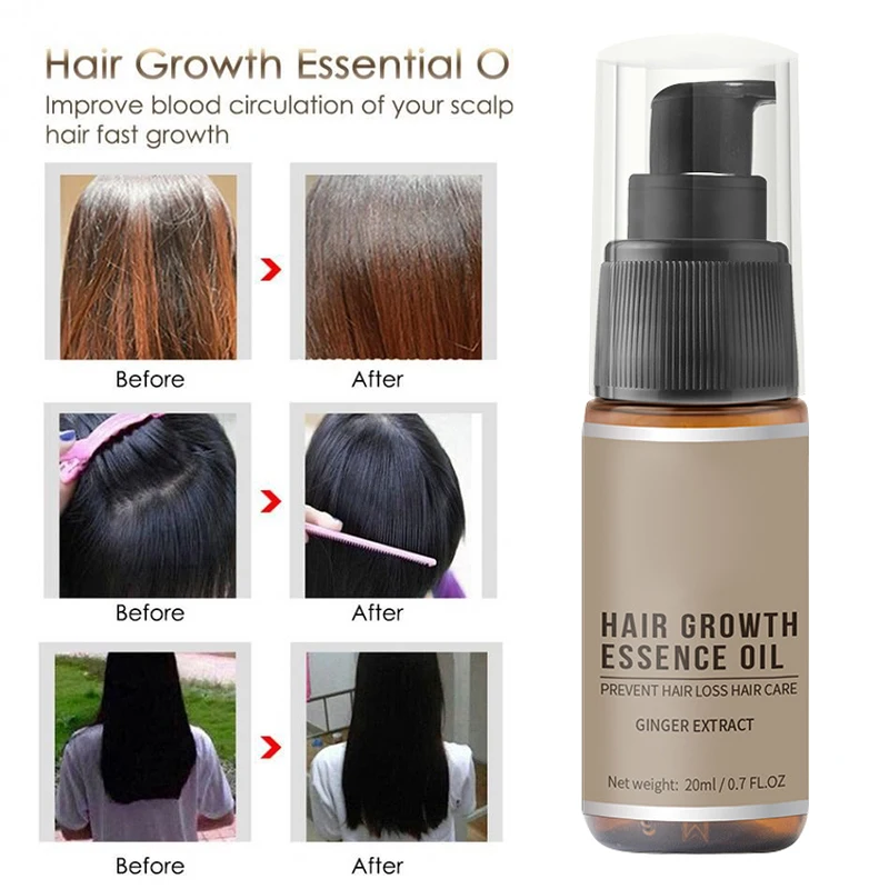 Эссенция для быстрого роста волос масло против выпадения помогает росту уход за