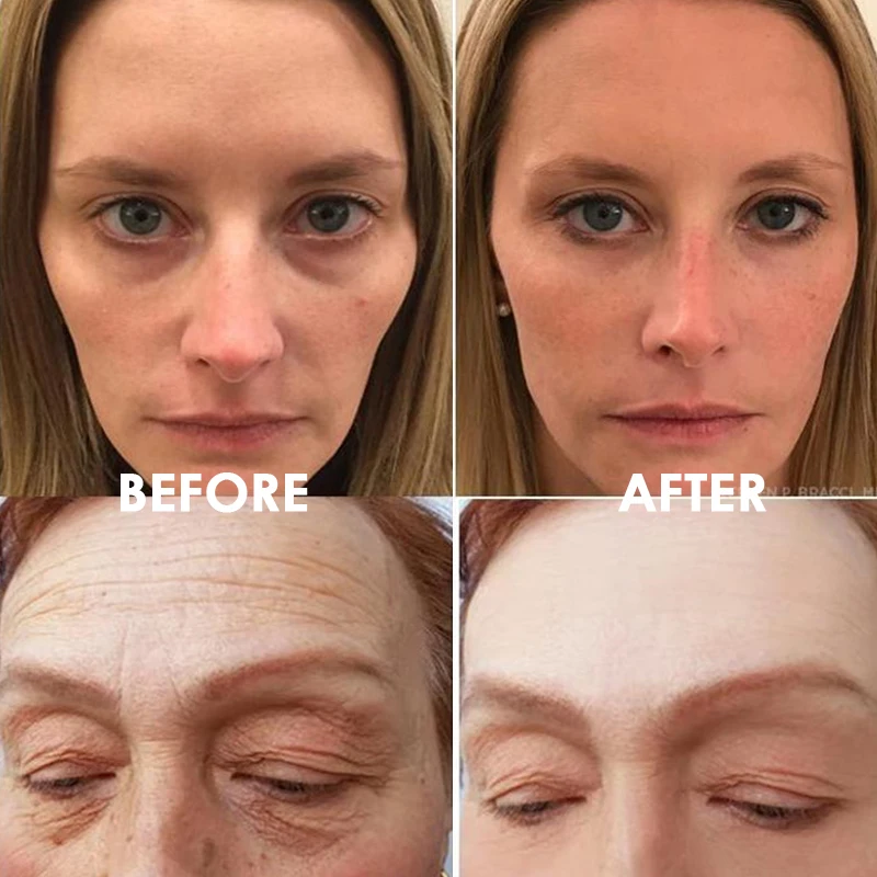 Eye Delight Boost Serum Instant Lifting Liquid Pump Eye Bag Removal Cream Effect Puffiness Wrinkles Fine Lines Dark Circles