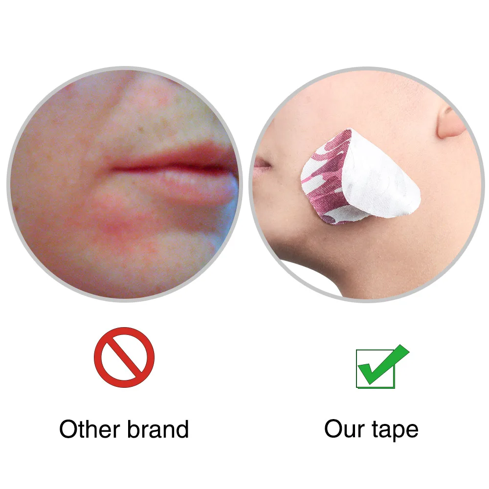 Кинезиологическая лента для лица эластопласт Спортивная фитнес-повязка
