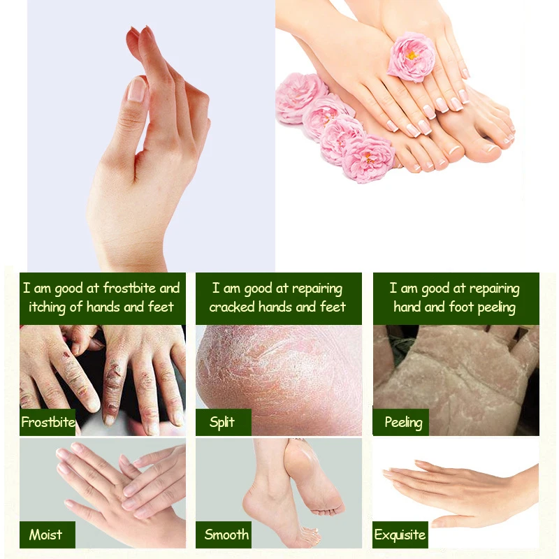 Конское масло крем для рук пятка ног набор ремонта анти сухая трещины