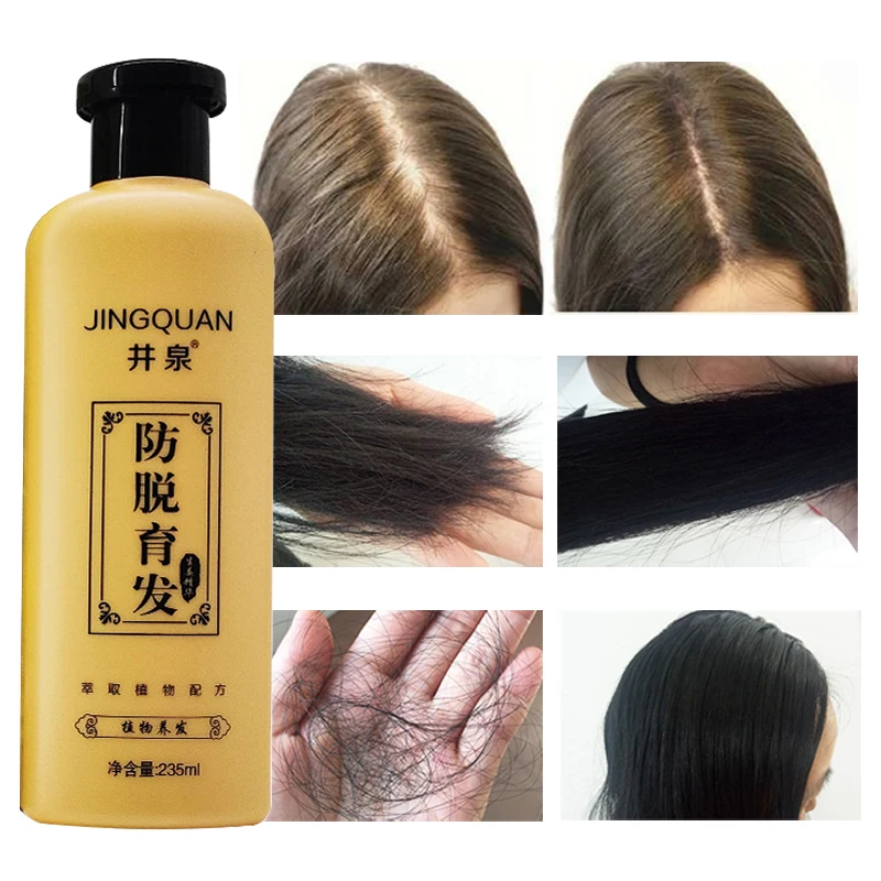 

Extract Sesame Seeds Shampoo Anti Alopecia Repair Damaged Hair Anti Dandruff Oil Control Shampoos Hair Cleansing Care 235ml