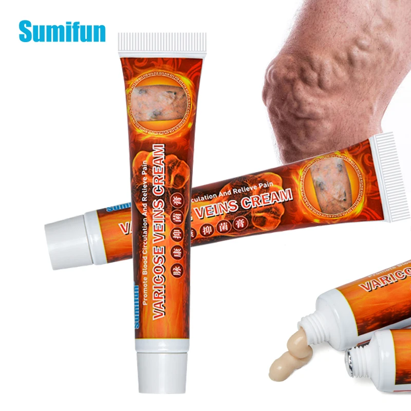 

Varicose Veins Treatment Cream Vasculitis Phlebitis Spider Pain Relief Ointment