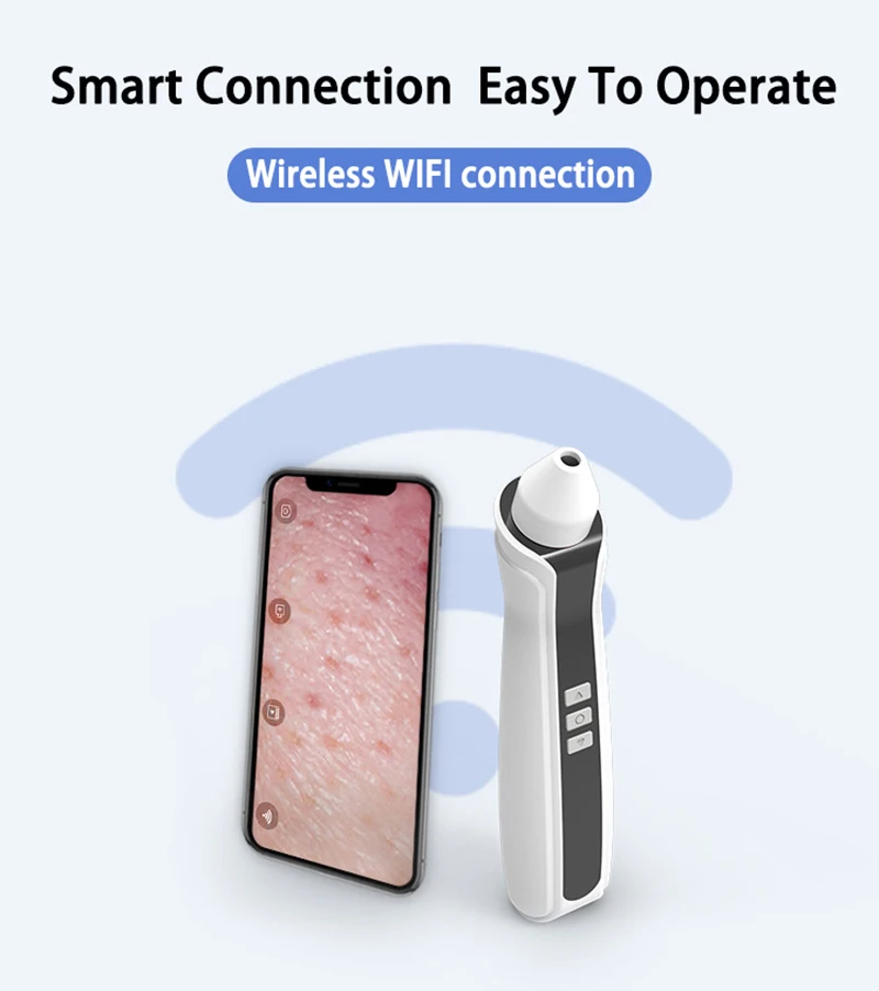 Новое поступление usb Перезаряжаемый вакуумный угрей всасывание удаление красота инструмент с 500 кратным увеличением электронный микроскоп