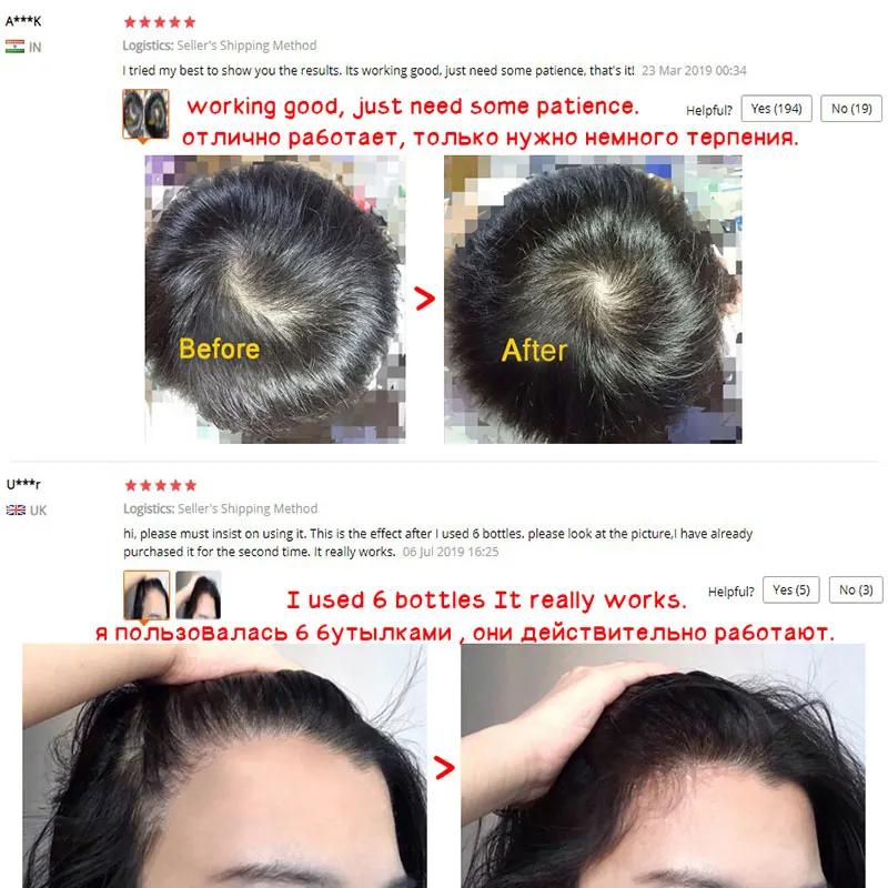 Имбирный спрей для роста волос быстрорастущие эфирные масла предотвращающие