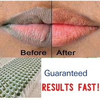 of lips pink fresh lightening bleaching cream treatment remove dark smoke lips lip oil 1pcs