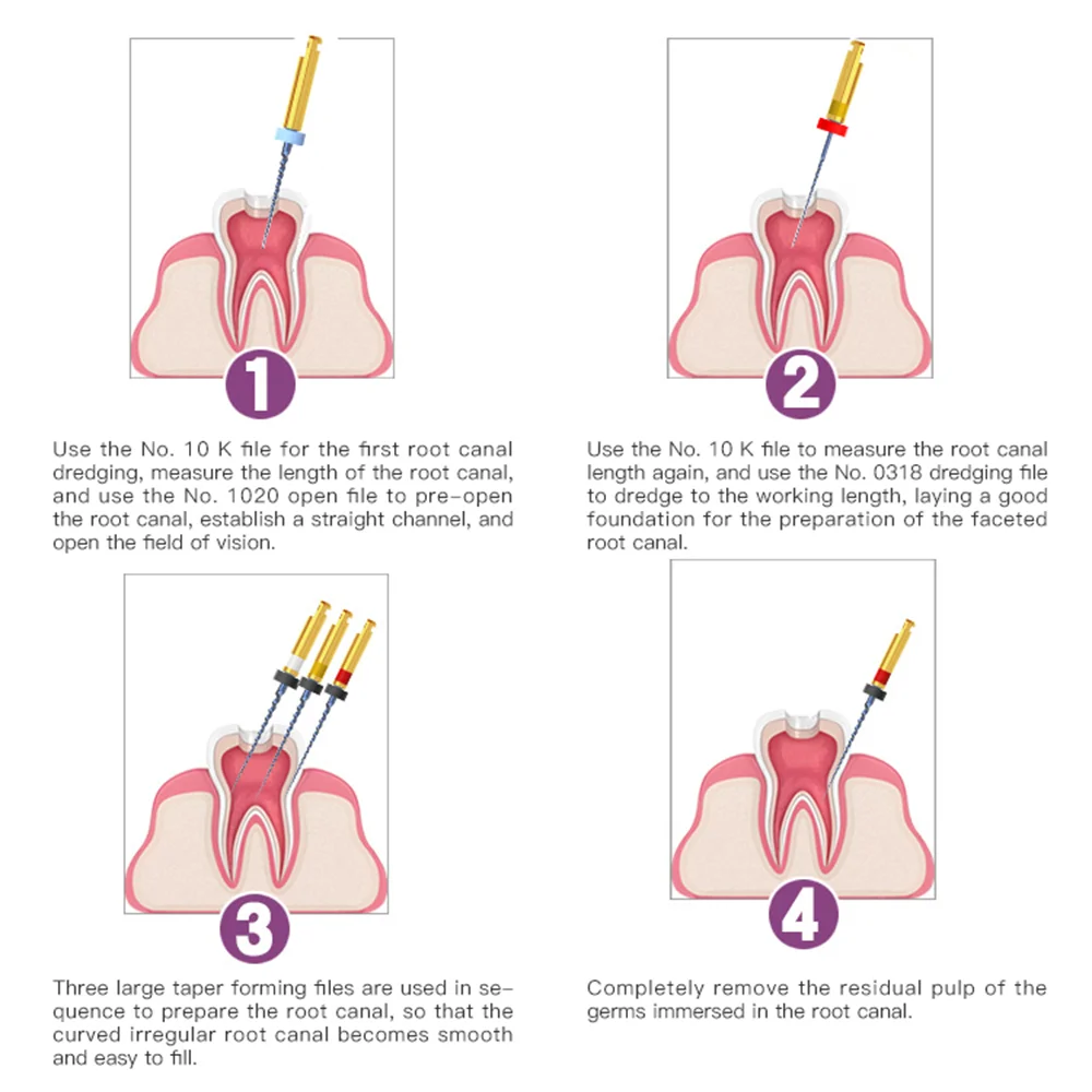 21 ~ 25 мм стоматологический корневой канал пилка с тепловой активацией