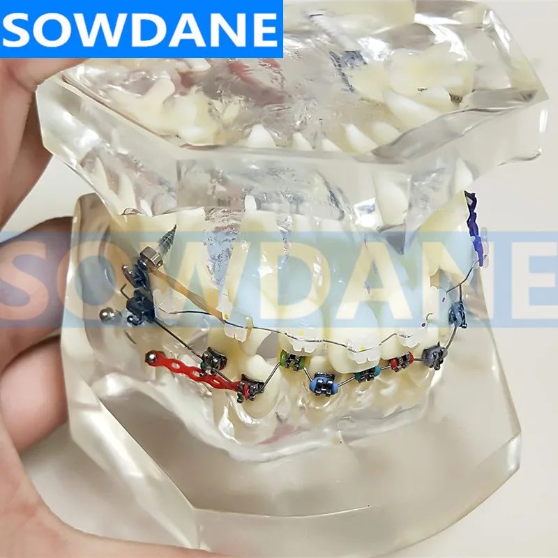 Прозрачная Стоматологическая Ортодонтическая модель для прикуса с двумя видами