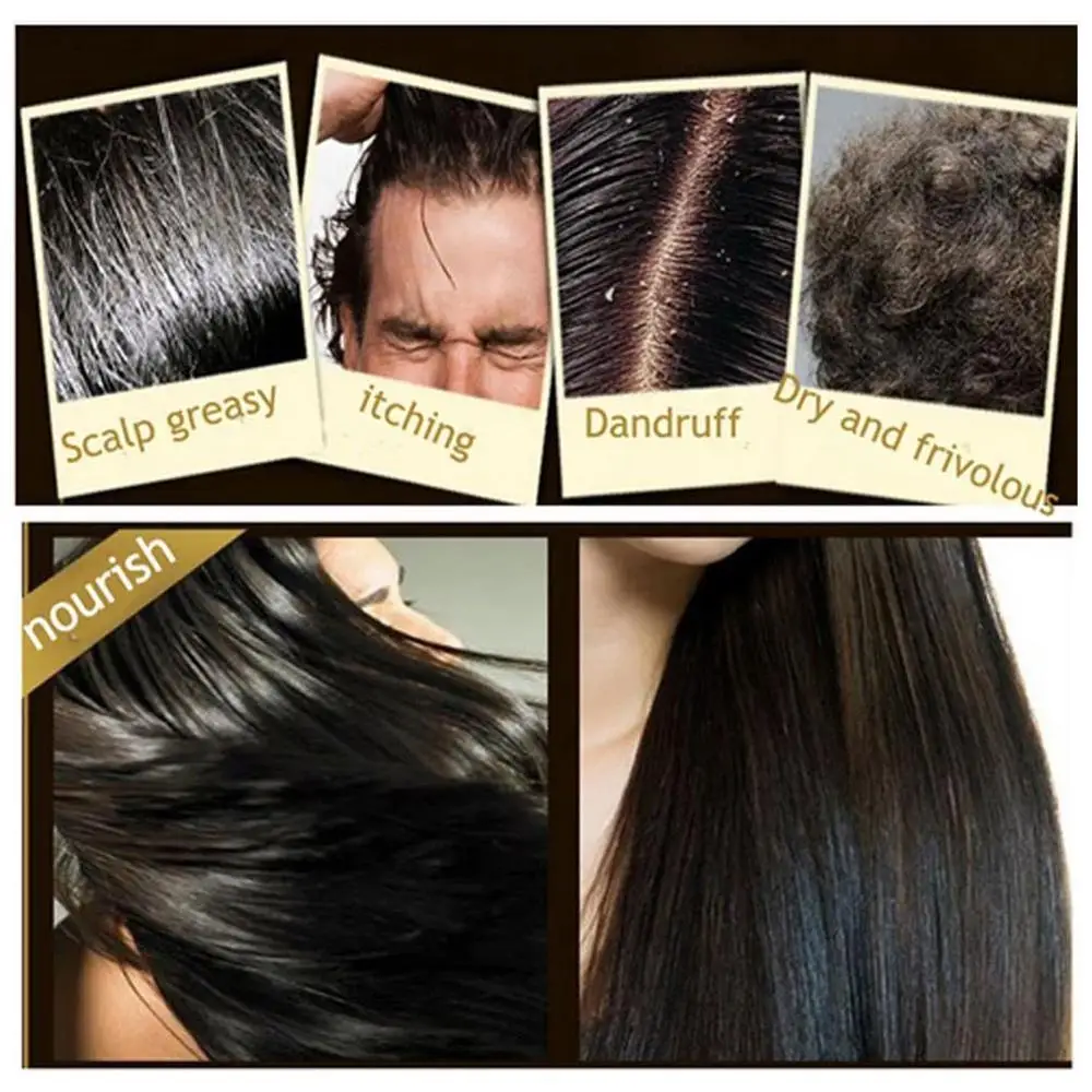 Шампунь для лечения выпадения волос Sevich 200 мл шампунь ухода за волосами против |